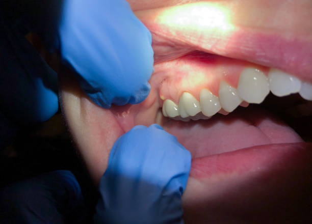 Best Broken or Chipped Tooth Repair in Grand Bay, AL